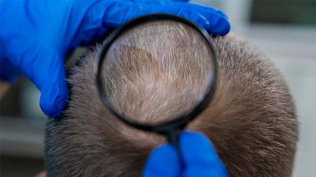 surgeon examining another man's hair and crown area