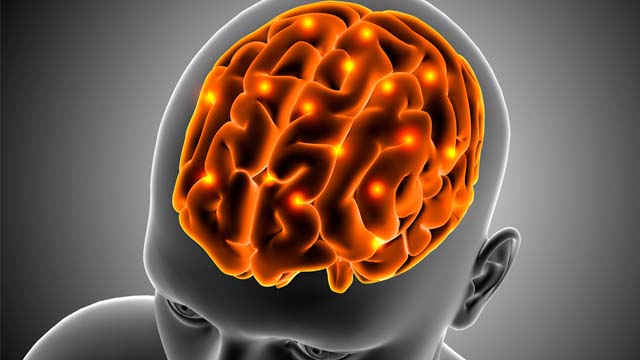 An x-ay of a man with his brain visible