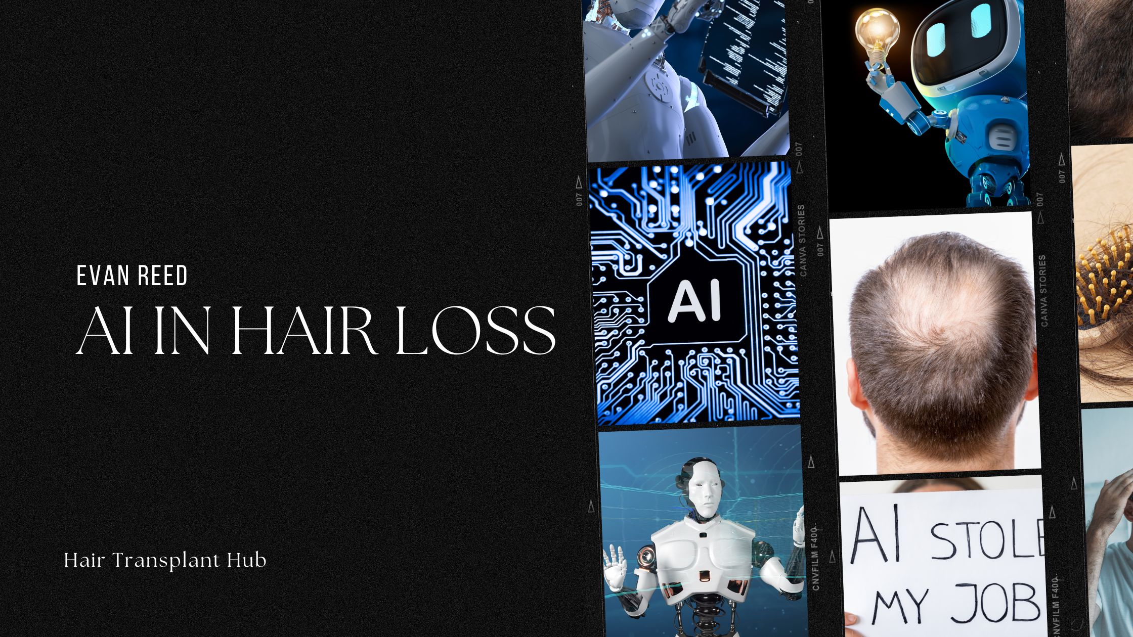 AI in Hair Loss